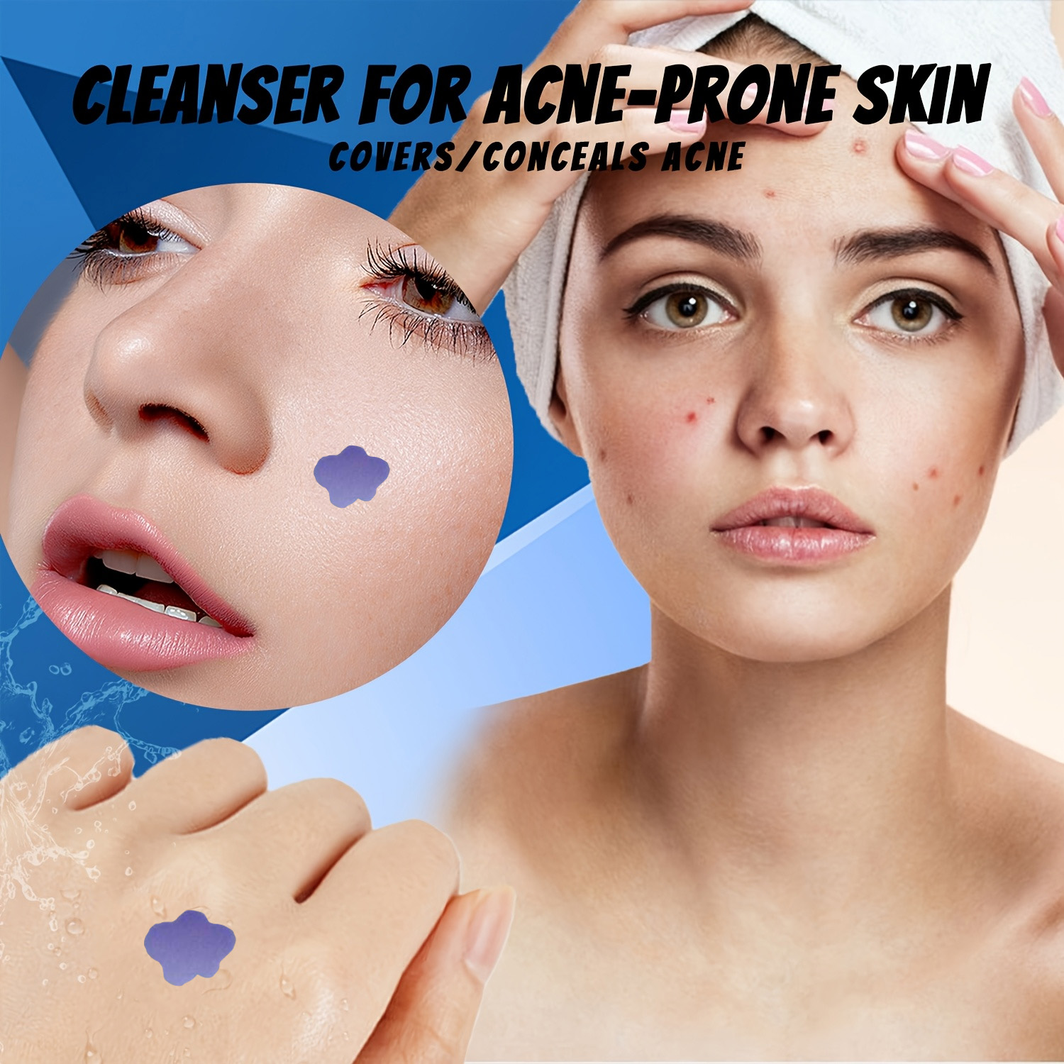 لاصقات علاج حب الشباب بالمايكر - مراجعة Skincare وسعره