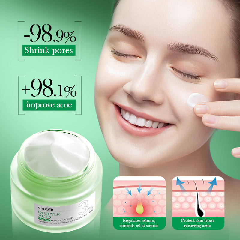 كريم علاج حب الشباب بحمض السال - مراجعة Salicylic Acid Blackhead Remover وسعره