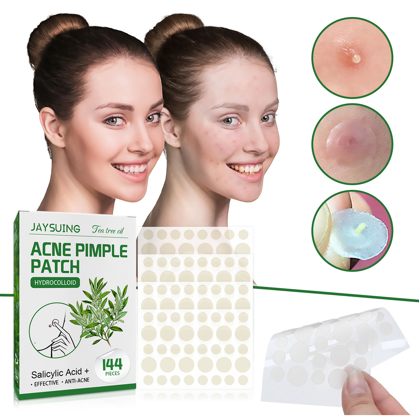 رقع حب الشباب الغروانية المائي - مراجعة Hydrocolloid Pimple Patch وسعره
