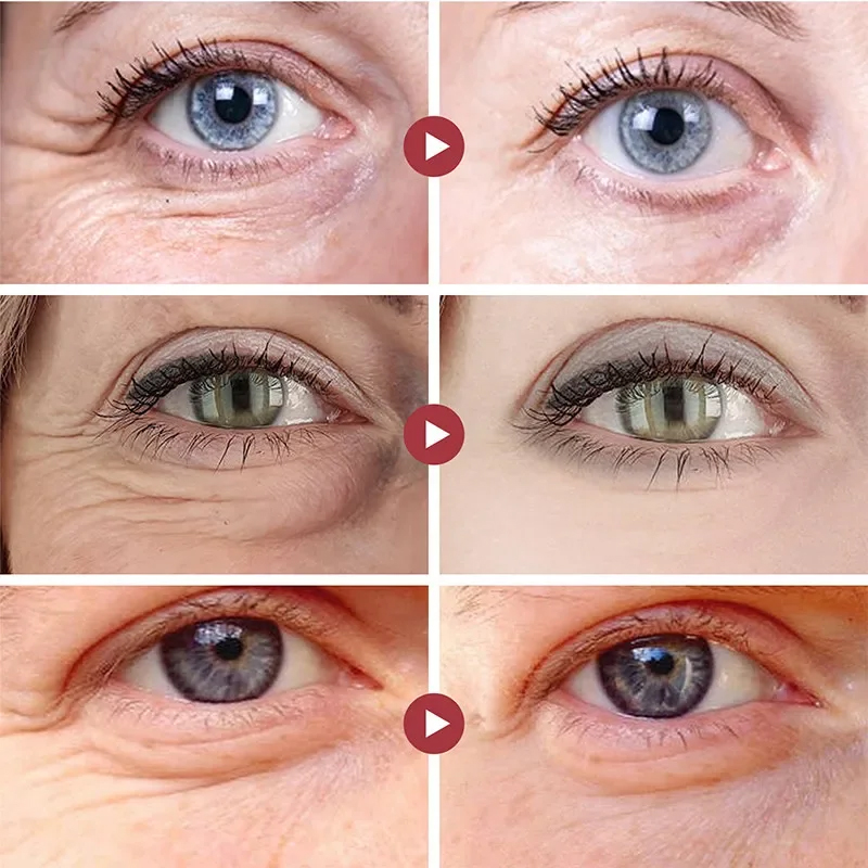 التجاعيد إزالة عيون بقع ثبات ر - مراجعة Collagen Under Eye Patches وسعره
