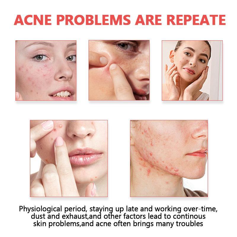 لصقات حب الشباب غير المرئية من - مراجعة Skincare وسعره